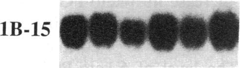 https://cdn.ncbi.nlm.nih.gov/pmc/blobs/6a1f/293869/7119249a7592/jcinvest00031-0047-e.jpg