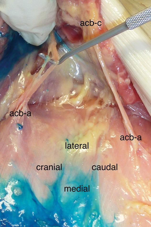 https://cdn.ncbi.nlm.nih.gov/pmc/blobs/6a27/5507869/23116e85cdfa/lra-10-061Fig4.jpg