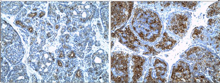 https://cdn.ncbi.nlm.nih.gov/pmc/blobs/6a28/11316835/e798b40ff40b/cureus-0016-00000064318-i05.jpg