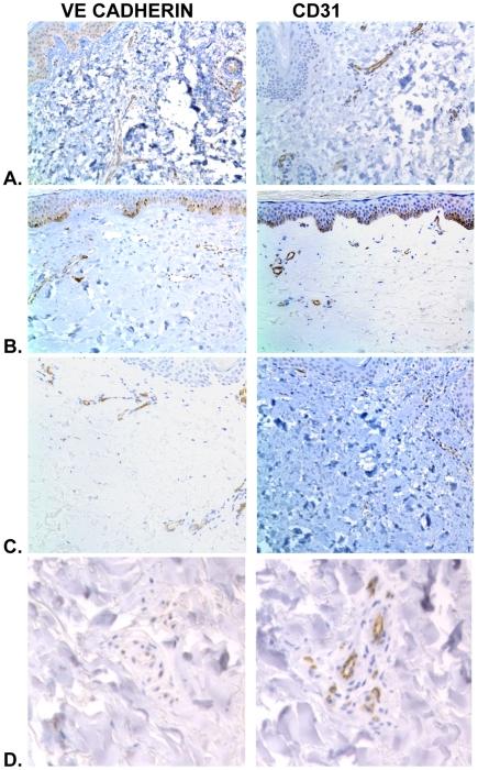 https://cdn.ncbi.nlm.nih.gov/pmc/blobs/6a29/2705674/70546937c65a/pone.0006203.g004.jpg