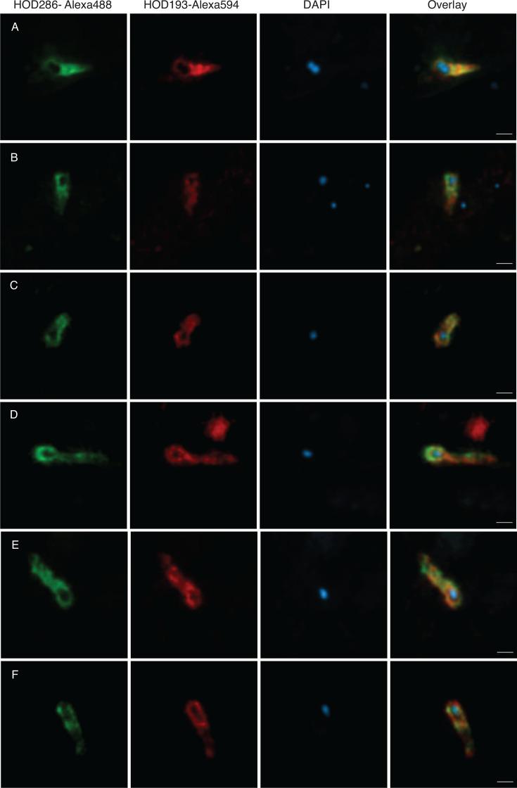 https://cdn.ncbi.nlm.nih.gov/pmc/blobs/6a30/12077186/87cc4f5336cf/mbio.00327-25.f002.jpg