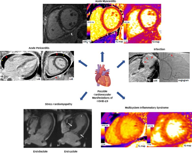 https://cdn.ncbi.nlm.nih.gov/pmc/blobs/6a33/10041810/5da9d2558036/12968_2023_933_Fig1_HTML.jpg