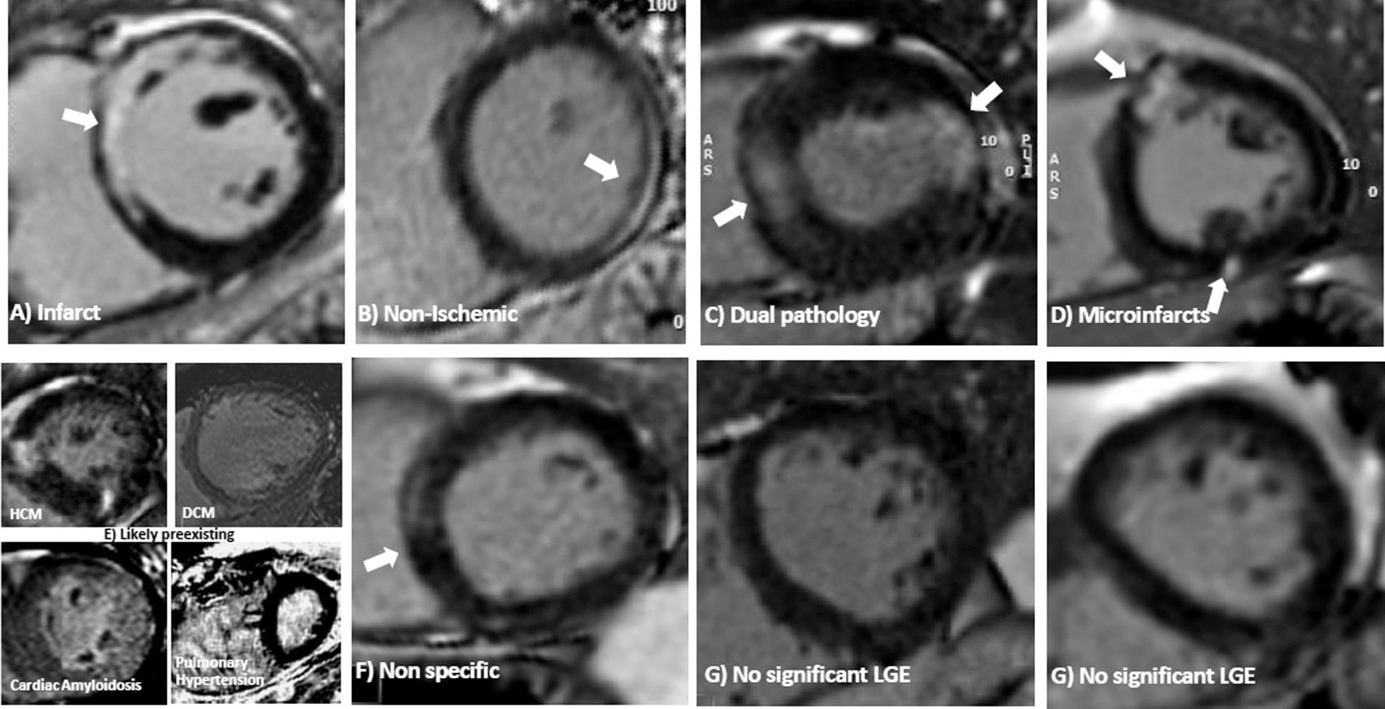 https://cdn.ncbi.nlm.nih.gov/pmc/blobs/6a33/10041810/7e1b6a95b832/12968_2023_933_Fig3_HTML.jpg