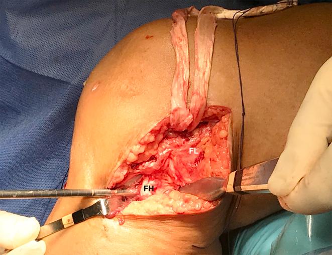 https://cdn.ncbi.nlm.nih.gov/pmc/blobs/6a34/9596733/10ba35e30546/gr8.jpg