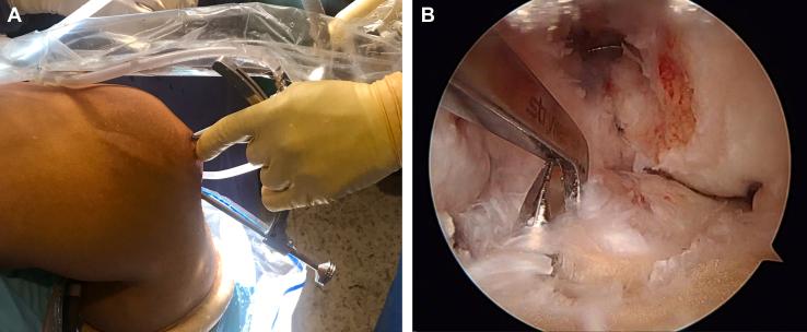 https://cdn.ncbi.nlm.nih.gov/pmc/blobs/6a34/9596733/96c8822e3e5b/gr3.jpg