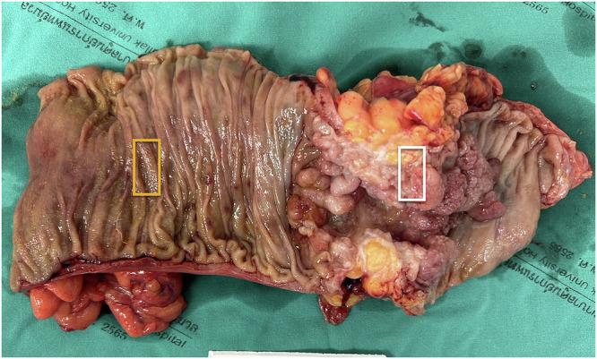 https://cdn.ncbi.nlm.nih.gov/pmc/blobs/6a39/11971325/55b9a14a30a3/41698_2025_873_Fig13_HTML.jpg