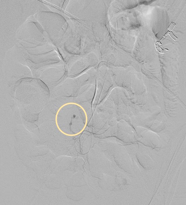 https://cdn.ncbi.nlm.nih.gov/pmc/blobs/6a3d/4855737/1ad93eef0b20/gr1.jpg