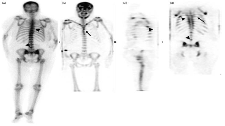 https://cdn.ncbi.nlm.nih.gov/pmc/blobs/6a3f/11353707/31e229c551cb/diagnostics-14-01827-g003.jpg