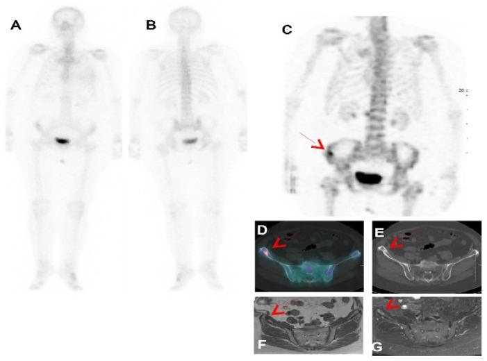 https://cdn.ncbi.nlm.nih.gov/pmc/blobs/6a3f/11353707/47a8bd28bd6d/diagnostics-14-01827-g001.jpg
