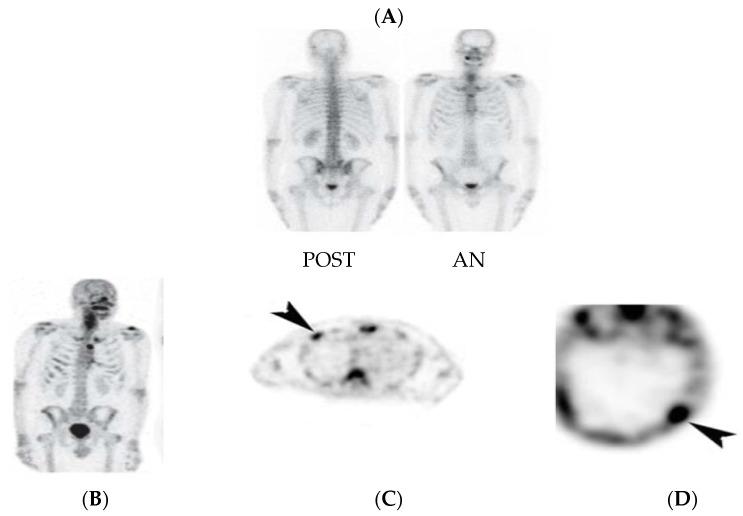 https://cdn.ncbi.nlm.nih.gov/pmc/blobs/6a3f/11353707/fbcaa3f2c95d/diagnostics-14-01827-g002.jpg