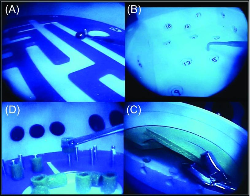https://cdn.ncbi.nlm.nih.gov/pmc/blobs/6a3f/5089855/06775eaf500b/sicotj-2-37-fig2.jpg