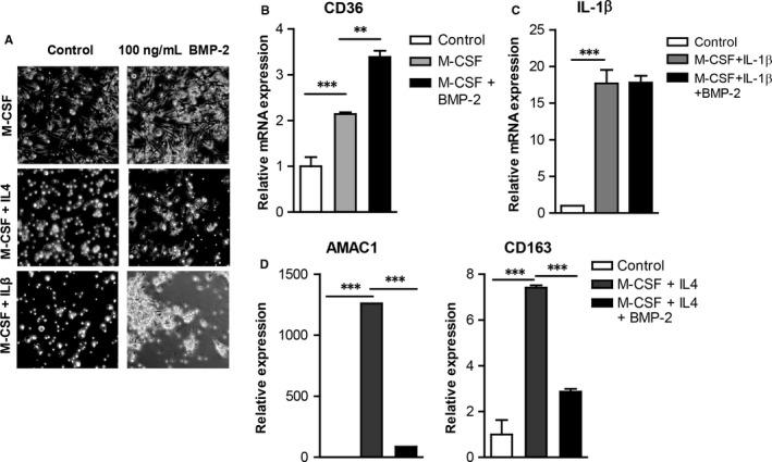 https://cdn.ncbi.nlm.nih.gov/pmc/blobs/6a3f/6201342/72c43536eebc/JCMM-22-5429-g003.jpg
