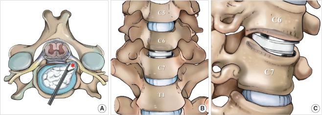 https://cdn.ncbi.nlm.nih.gov/pmc/blobs/6a41/11456947/463384496ce4/ns-2448582-291f1.jpg