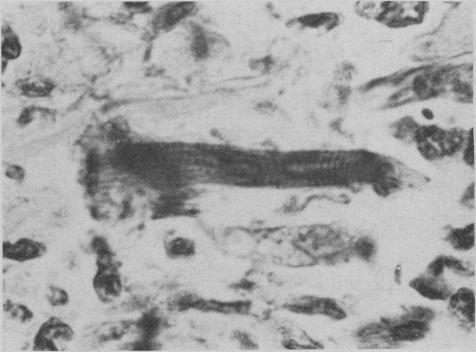 https://cdn.ncbi.nlm.nih.gov/pmc/blobs/6a52/1939000/889a14d8d6c9/canmedaj00869-0034-d.jpg