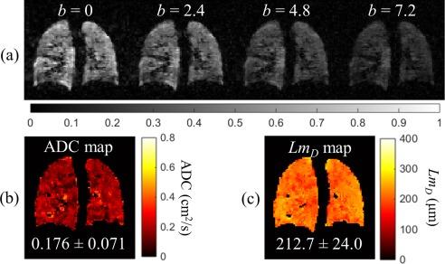 https://cdn.ncbi.nlm.nih.gov/pmc/blobs/6a52/5412864/67aa64488295/MRM-77-1916-g003.jpg