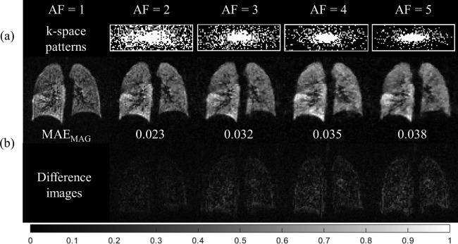 https://cdn.ncbi.nlm.nih.gov/pmc/blobs/6a52/5412864/74a76a651989/MRM-77-1916-g001.jpg