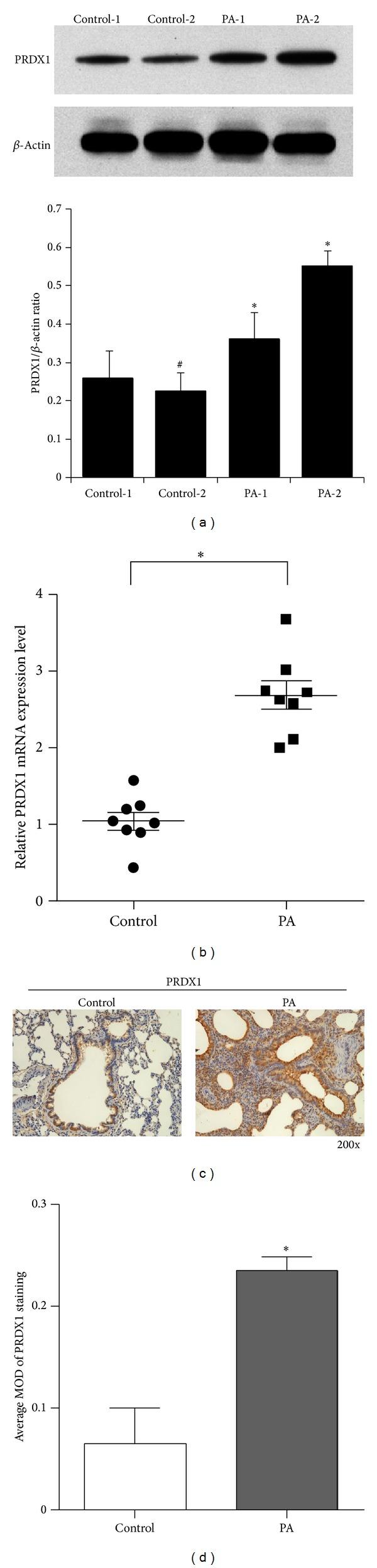 https://cdn.ncbi.nlm.nih.gov/pmc/blobs/6a53/4082880/305abca6743b/MI2014-469358.003.jpg