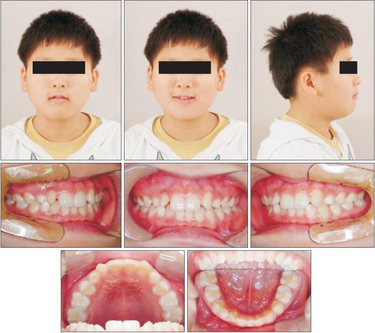 https://cdn.ncbi.nlm.nih.gov/pmc/blobs/6a53/5548713/52f4fb76f8bd/kjod-47-323-g001.jpg
