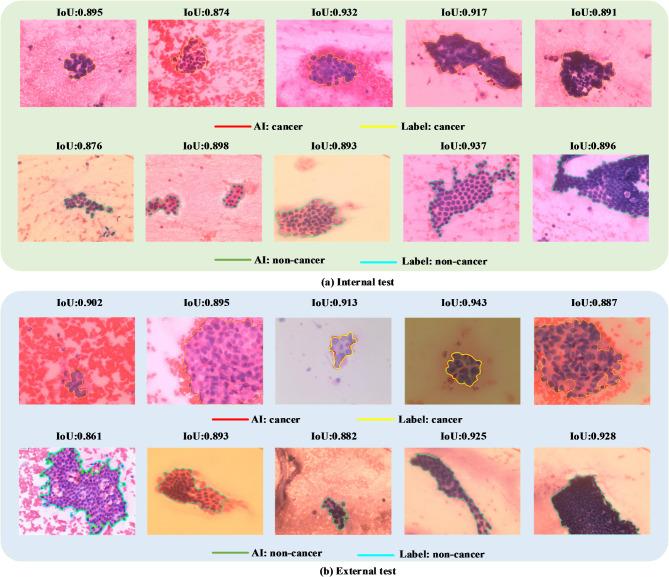 https://cdn.ncbi.nlm.nih.gov/pmc/blobs/6a55/11917044/bfbf6dbe1563/12885_2025_13910_Fig4_HTML.jpg
