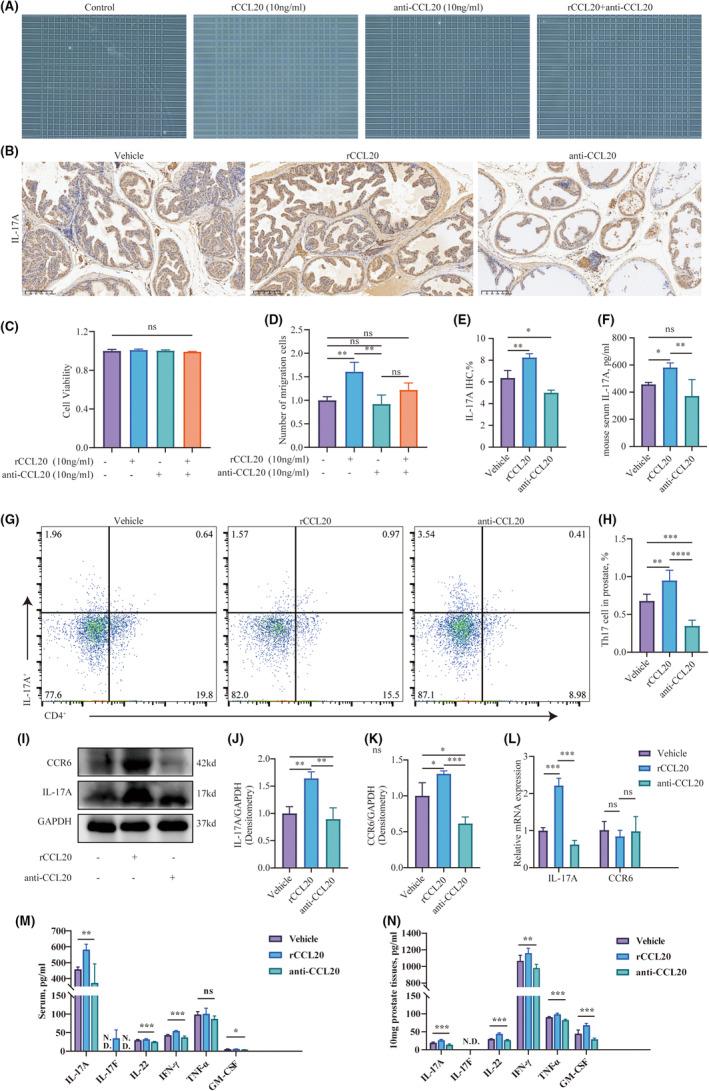 https://cdn.ncbi.nlm.nih.gov/pmc/blobs/6a57/11129727/8fcc4d3a4cb4/JCMM-28-e18445-g002.jpg