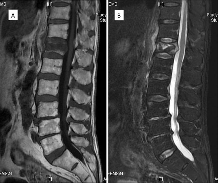 https://cdn.ncbi.nlm.nih.gov/pmc/blobs/6a58/11625722/acc12d783a8f/2432-261X-8-0600-g003.jpg