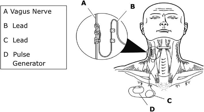 https://cdn.ncbi.nlm.nih.gov/pmc/blobs/6a5a/7083506/3176c5995a11/EHF2-7-75-g002.jpg