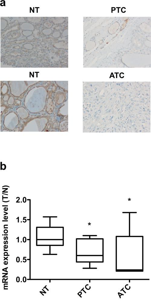 https://cdn.ncbi.nlm.nih.gov/pmc/blobs/6a5c/5342575/d694bd89e336/oncotarget-07-70575-g008.jpg
