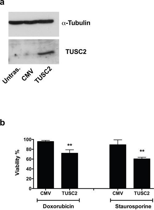https://cdn.ncbi.nlm.nih.gov/pmc/blobs/6a5c/5342575/ee12a55dc822/oncotarget-07-70575-g007.jpg