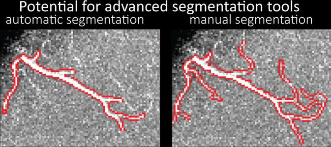 https://cdn.ncbi.nlm.nih.gov/pmc/blobs/6a61/9150892/57d6deb2f89b/elife-71186-fig7-figsupp3.jpg