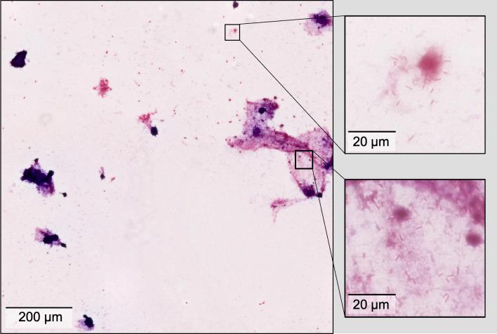 https://cdn.ncbi.nlm.nih.gov/pmc/blobs/6a63/11898657/783c4971ef20/jcm.01514-24.f002.jpg