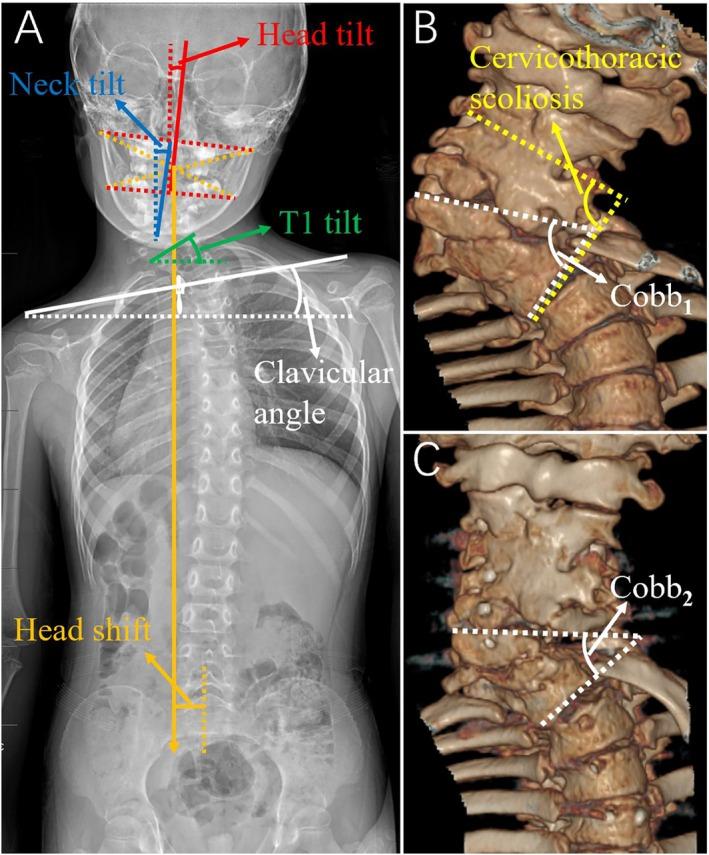 https://cdn.ncbi.nlm.nih.gov/pmc/blobs/6a63/12214400/5bafa86adfef/OS-17-2159-g002.jpg