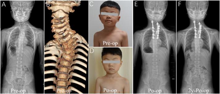 https://cdn.ncbi.nlm.nih.gov/pmc/blobs/6a63/12214400/cd6c00bf49c3/OS-17-2159-g007.jpg