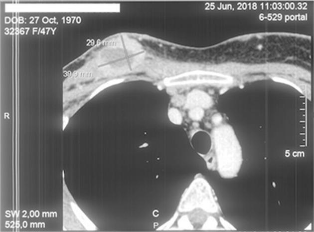 https://cdn.ncbi.nlm.nih.gov/pmc/blobs/6a63/6980632/8ca3d8fafe8e/oncotarget-11-294-g002.jpg