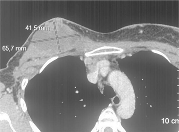 https://cdn.ncbi.nlm.nih.gov/pmc/blobs/6a63/6980632/ae6f3a3ddacb/oncotarget-11-294-g001.jpg