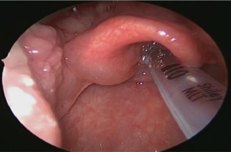 https://cdn.ncbi.nlm.nih.gov/pmc/blobs/6a67/10202163/5a05088289da/ijo-35-101-g004.jpg