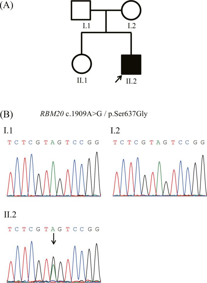 https://cdn.ncbi.nlm.nih.gov/pmc/blobs/6a72/7331393/d39ae4491e11/PED4-4-11-g004.jpg