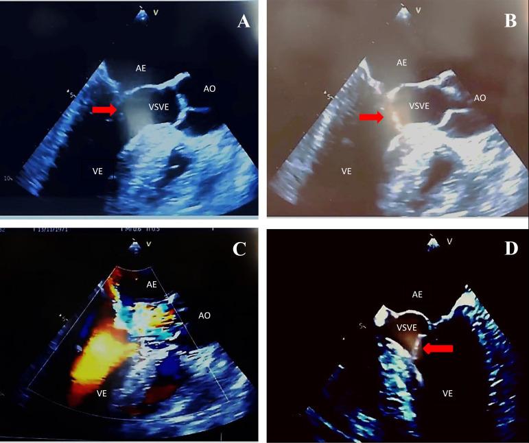 https://cdn.ncbi.nlm.nih.gov/pmc/blobs/6a72/7918378/ffd8f7c5fe5c/rbccv-36-01-0116-g01.jpg
