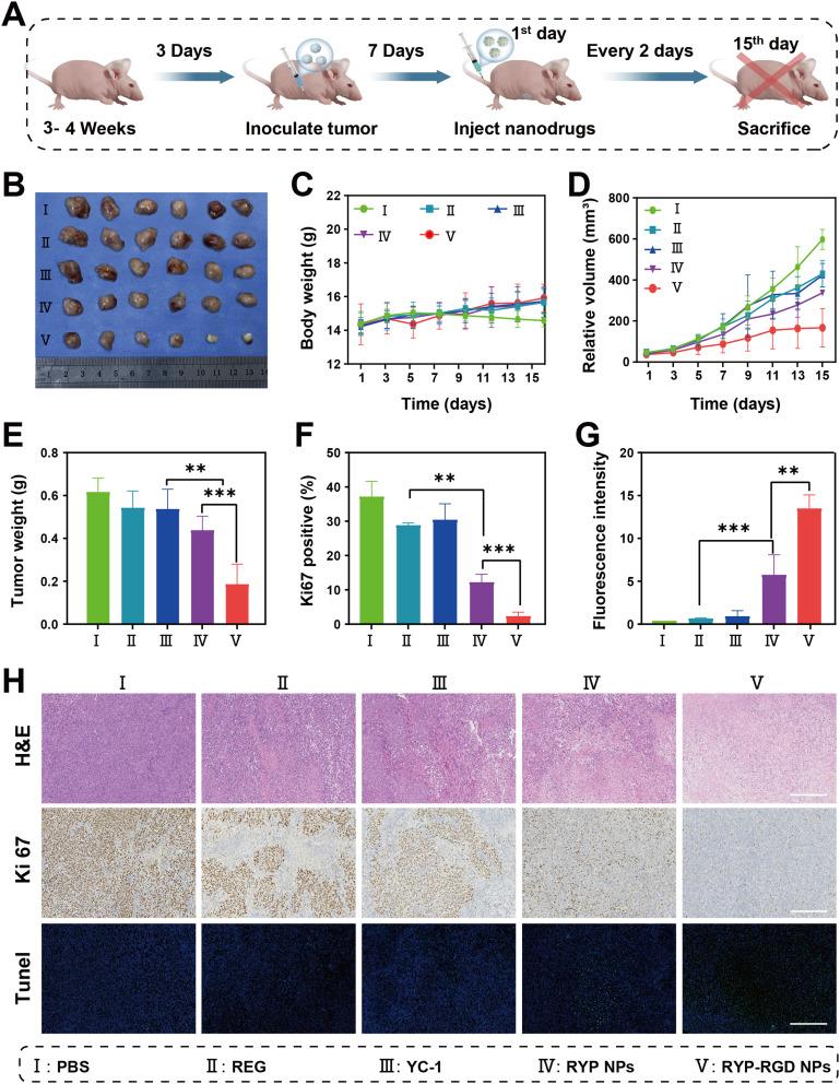 https://cdn.ncbi.nlm.nih.gov/pmc/blobs/6a77/12228521/511b9a4fe8fa/IJN-20-8481-g0005.jpg