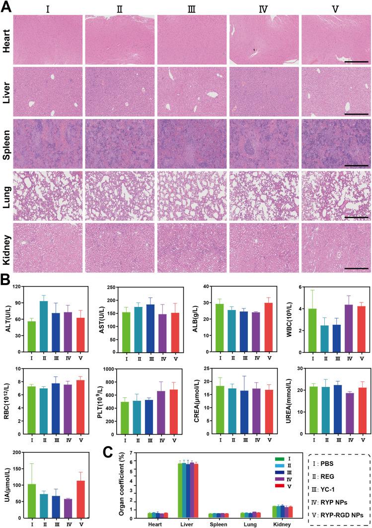 https://cdn.ncbi.nlm.nih.gov/pmc/blobs/6a77/12228521/5cba4fa893f5/IJN-20-8481-g0006.jpg