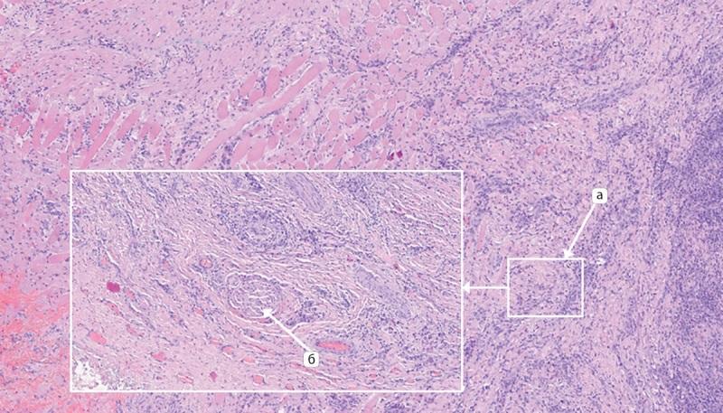 https://cdn.ncbi.nlm.nih.gov/pmc/blobs/6a78/11145568/4749cc1aedab/problendo-70-13379-g005.jpg