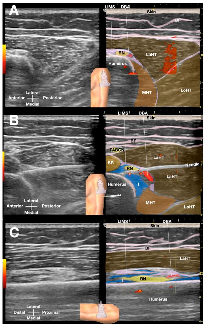 https://cdn.ncbi.nlm.nih.gov/pmc/blobs/6a7d/12346177/c80ed9ed0821/diagnostics-15-01880-g001.jpg
