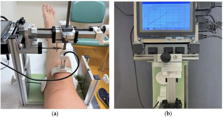 https://cdn.ncbi.nlm.nih.gov/pmc/blobs/6a7f/9920919/3fe05cab25a1/sensors-23-01274-g002.jpg
