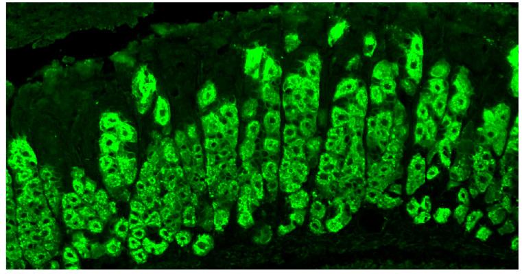 https://cdn.ncbi.nlm.nih.gov/pmc/blobs/6a82/11354099/b95de3d405af/diagnostics-14-01721-g001.jpg