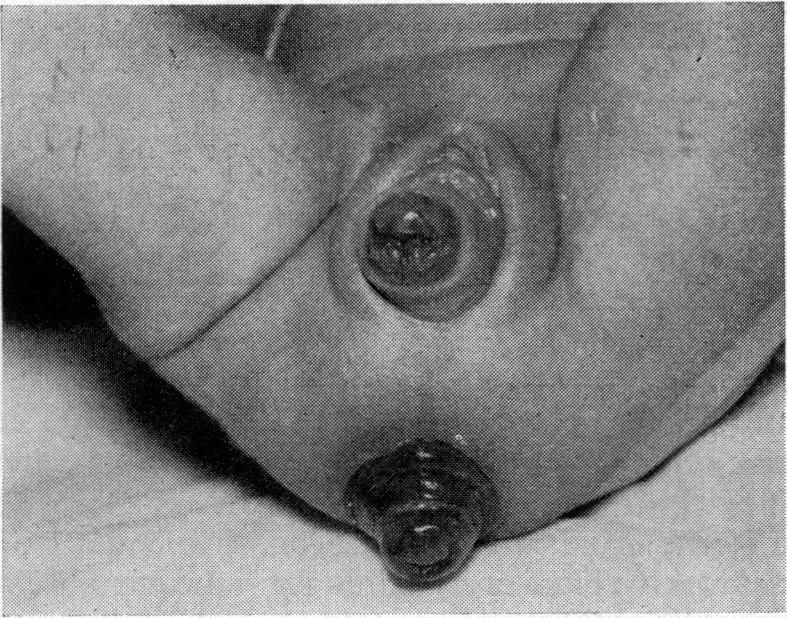 https://cdn.ncbi.nlm.nih.gov/pmc/blobs/6a84/1900777/2617ae19b949/procrsmed00185-0017-a.jpg