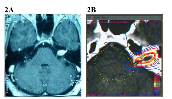 https://cdn.ncbi.nlm.nih.gov/pmc/blobs/6a8a/1764417/26569e5f9c4f/1748-717X-1-46-2.jpg