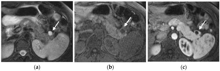 https://cdn.ncbi.nlm.nih.gov/pmc/blobs/6a8b/12071918/96198faa730b/diagnostics-15-01164-g005a.jpg