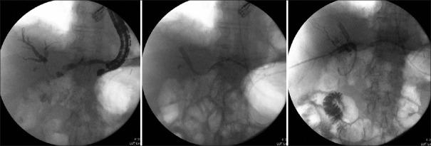 https://cdn.ncbi.nlm.nih.gov/pmc/blobs/6a8f/7980690/7dec2477beaf/EUS-10-51-g002.jpg