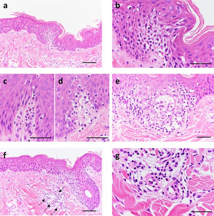 https://cdn.ncbi.nlm.nih.gov/pmc/blobs/6a91/8828599/910ec19522cc/tox-35-103-g003.jpg