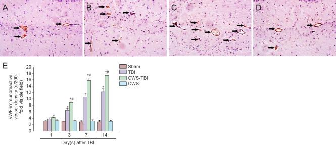 https://cdn.ncbi.nlm.nih.gov/pmc/blobs/6a94/5607828/f28c6073eeb6/NRR-12-1322-g005.jpg