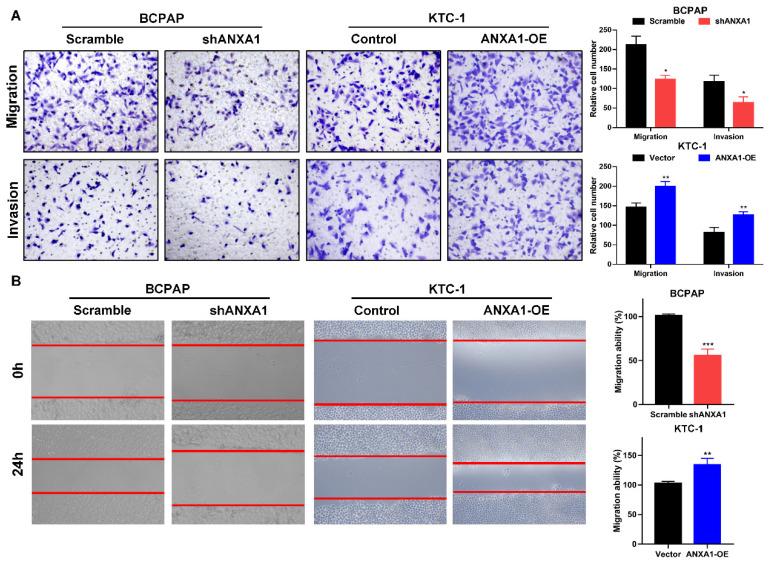 https://cdn.ncbi.nlm.nih.gov/pmc/blobs/6a94/7847635/ced2dcec1e58/jcav12p1295g004.jpg